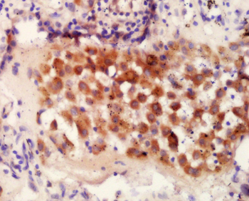 IRF9/ISGF3 Rabbit Polyclonal Antibody