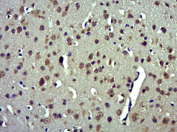 Phospho-IP3 receptor (Ser1598) Rabbit Polyclonal Antibody