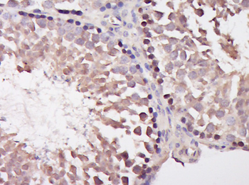 IP3KC Rabbit Polyclonal Antibody