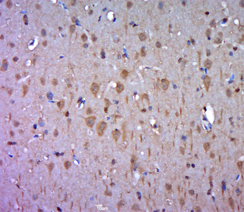 Jaw1 Rabbit Polyclonal Antibody