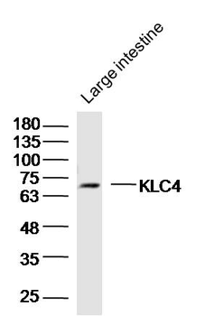 KLC4 Rabbit Polyclonal Antibody