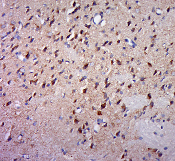 KLHDC10 Rabbit Polyclonal Antibody