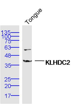 KLHDC2 Rabbit Polyclonal Antibody