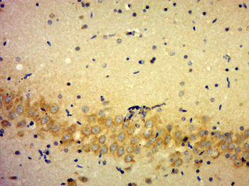 KLHDC7B Rabbit Polyclonal Antibody