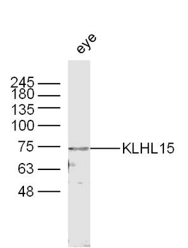 KLHL15 Rabbit Polyclonal Antibody