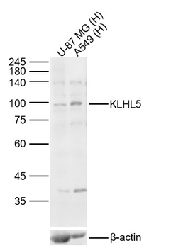 KLHL5 Rabbit Polyclonal Antibody