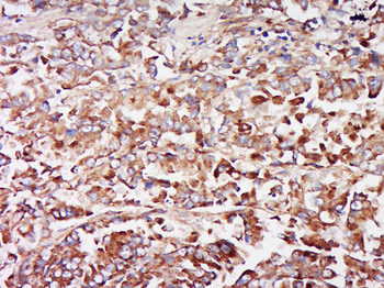 KLRC4 Rabbit Polyclonal Antibody