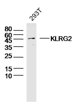 KLRG2 Rabbit Polyclonal Antibody