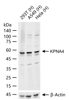 KPNA4 Rabbit Polyclonal Antibody