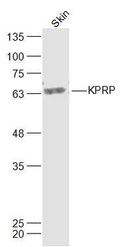 KPRP Rabbit Polyclonal Antibody