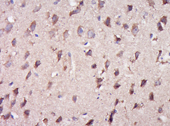 KRT74 Rabbit Polyclonal Antibody