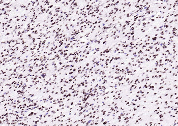 Histone H3 (Tri Methyl K4) Rabbit Polyclonal Antibody