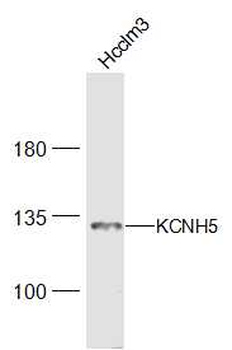 KCNH5 Rabbit Polyclonal Antibody