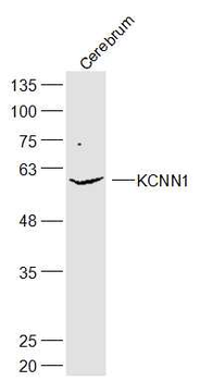 KCNN1 Rabbit Polyclonal Antibody
