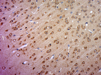 KCNV1 Rabbit Polyclonal Antibody