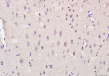 KCTD19 Rabbit Polyclonal Antibody