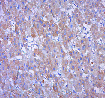 Keratin 36 Rabbit Polyclonal Antibody