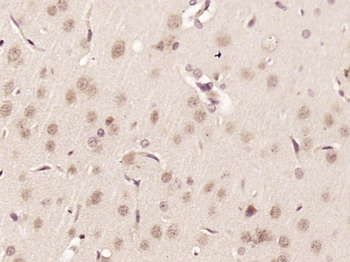 KIAA0355 Rabbit Polyclonal Antibody