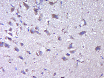 KIAA0513 Rabbit Polyclonal Antibody