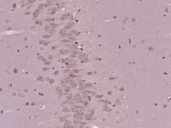 KIAA1609 Rabbit Polyclonal Antibody