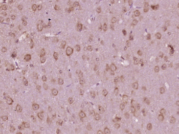 KIFAP3 Rabbit Polyclonal Antibody
