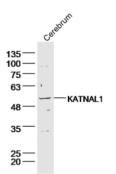 KATNAL1 Rabbit Polyclonal Antibody