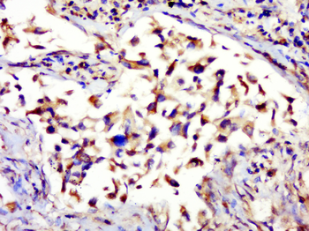 Phospho-ALOX5 (Ser524) Rabbit Polyclonal Antibody