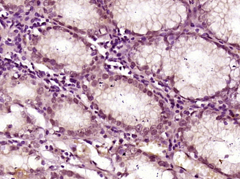 L3MBTL2 Rabbit Polyclonal Antibody