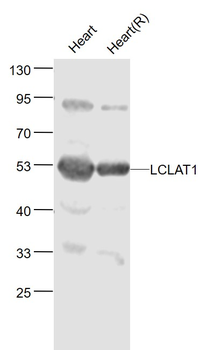LCLAT1 Rabbit Polyclonal Antibody
