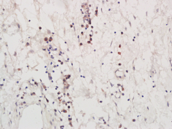 Leucyl tRNA synthetase Rabbit Polyclonal Antibody