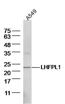 LHFPL1 Rabbit Polyclonal Antibody