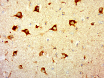 LHFPL5 Rabbit Polyclonal Antibody