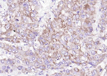 Phospho-LIM Kinase 1 (Thr508) Rabbit Polyclonal Antibody