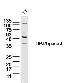 LIPJ/Lipase J Rabbit Polyclonal Antibody
