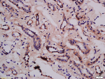 LMAN1 Rabbit Polyclonal Antibody