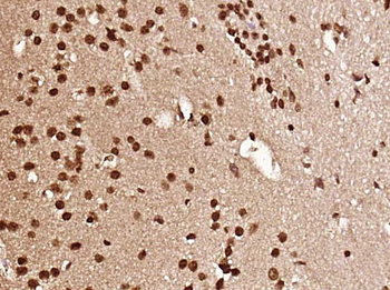 LMO1 Rabbit Polyclonal Antibody