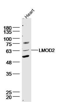 LMOD2 Rabbit Polyclonal Antibody
