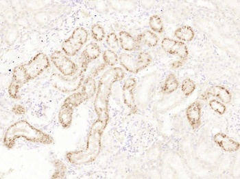 LPHN1 antibody
