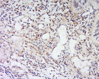 LRRC26 Rabbit Polyclonal Antibody
