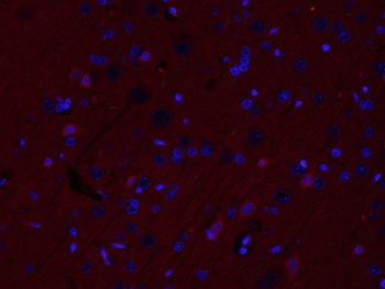 LRRC33 Rabbit Polyclonal Antibody