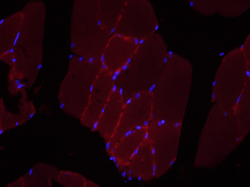 LRRC33 Rabbit Polyclonal Antibody