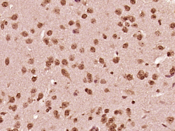 LSMD1 Rabbit Polyclonal Antibody
