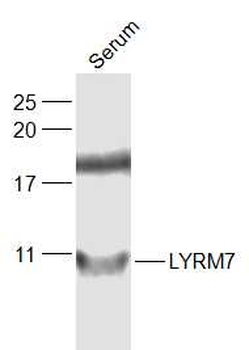 LYRM7 Rabbit Polyclonal Antibody