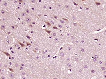 LPCAT2 Rabbit Polyclonal Antibody
