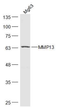 MMP13 Rabbit Polyclonal Antibody