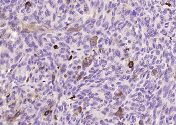 Melanoma gp100 Rabbit Polyclonal Antibody