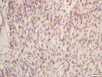 METTL14 Rabbit Polyclonal Antibody