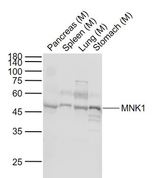MNK1 antibody