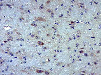 MOXD1 Rabbit Polyclonal Antibody