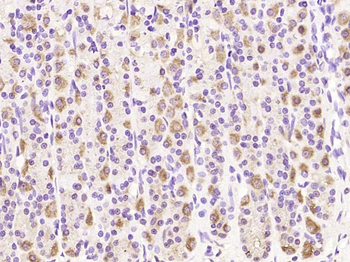 MRPL20 Rabbit Polyclonal Antibody